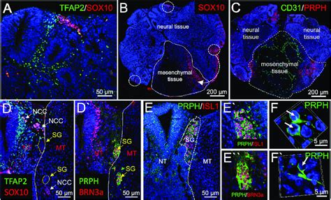 Neural crest cell migration and sensory ganglion formation in ...