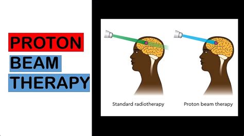 What Is Proton Beam Therapy New Cure For Cancer UPSC CSE 2023