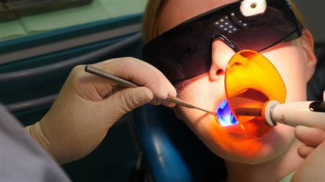 Dentist Fixing Light Filling Using Photopolymer Dental Cordless Lamp