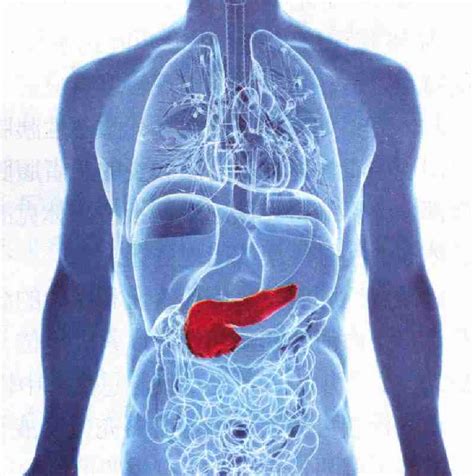 急性胰腺炎 生活乐读 医学