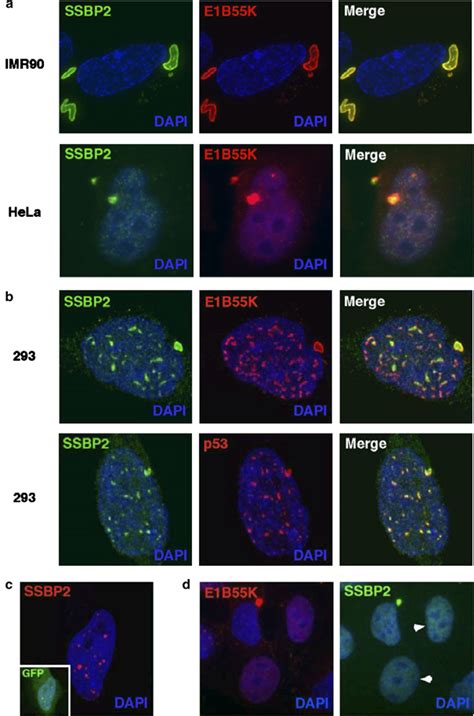 E1B55K Expression And Localization Affects The Localization Of SSBP2