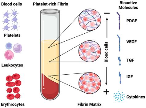 Jfb Free Full Text The Effects Of Platelet Rich Fibrin In The