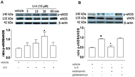 Western Blot Analysis For Enos And P Enos Ser 1177 In Hcc Tissue Panel Download Scientific