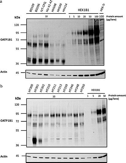 Western Blot Analysis Of Oatp B Expression Total Protein From A