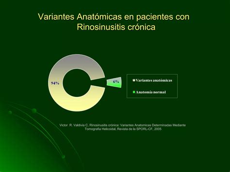 Cirugia Endoscopica En El Papiloma Nasal Ppt