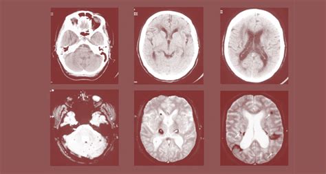 Brain_Scans_toned | NIHR Oxford Biomedical Research Centre