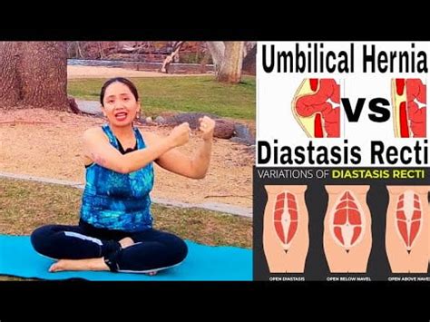 Lose Belly Fat Post Hernia Surgery Yoga Vs Pilates Expert Insights