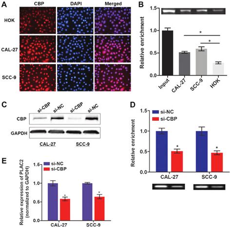 The H3K27 Acetylation Process Is Mediated By CBP A CBP Level Was