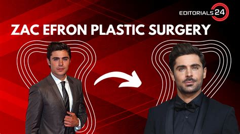 Zac Efron Plastic Surgery: The Celebrity Zac Efron Revealed the "Jaw ...