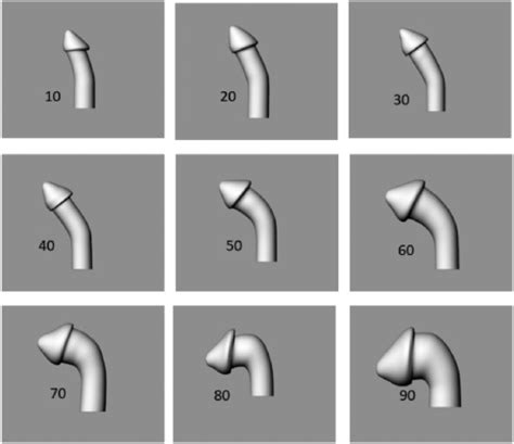 A New Method For Measuring Penile Curvature Based On Digital Images