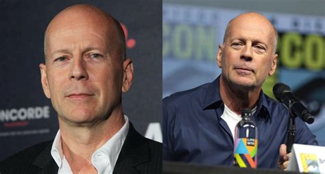 Bruce Willis Se Retira De La Actuaci N Tras Ser Diagnosticado Con Un