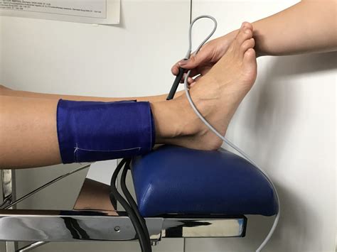 Arterielle Dopplerdruckmessung Dr Med Murena Schmidt