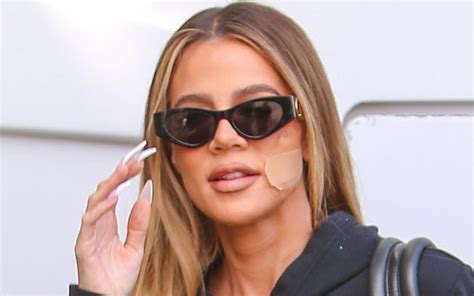 Khloe Kardashian Says She Is Healing Wonderfully After Face Tumor Removal