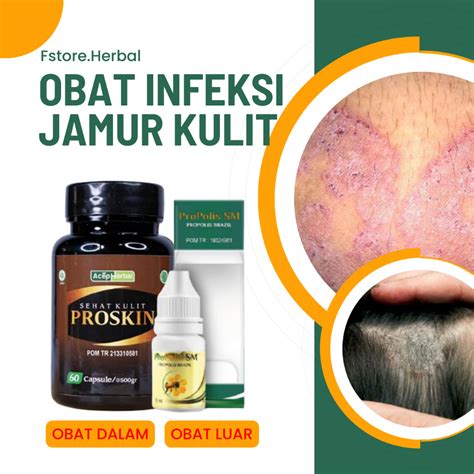 Jual Obat Scabies Gatal Kulit Seluruh Badan Selangkangan Jamur Kulit