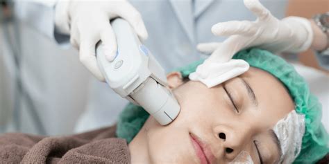 Hifu Facial Guide For Non Invasive Rejuvenation