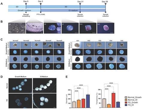 Cells Free Full Text Patient Derived Organoids Recapitulate