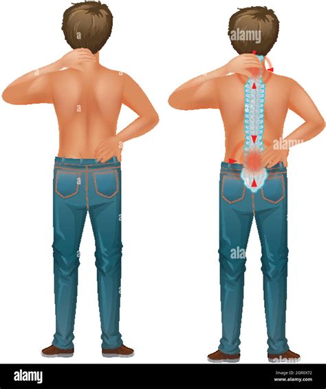 Male Human With Back Pain Stock Vector Image Art Alamy