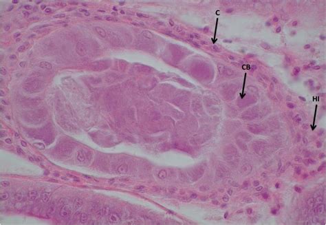 Histological Section Of The Hepatopancreas Of Penaeus Vannamei Showing