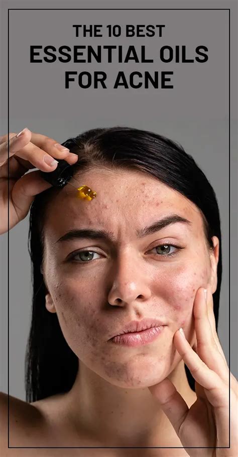 10 Best Essential Oils For Acne How To Use