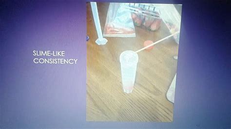 Dna And Rna Lab 13 Youtube