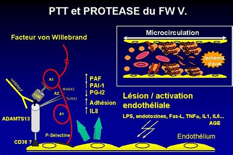 Microangiopathies Thrombotiques Physiopathologie Classification Paul