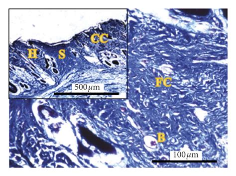 Massons Trichome Stained Histopathological Section Of Rats Skin