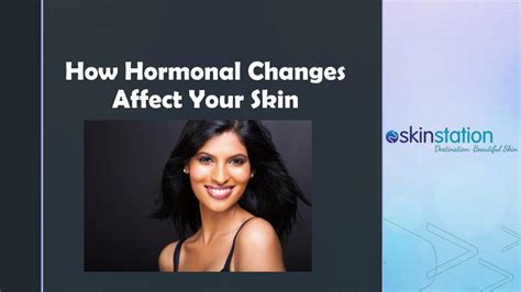 hormonal  affect  skin powerpoint