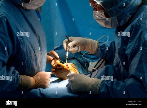 HALLUX VALGUS SURGERY Stock Photo - Alamy