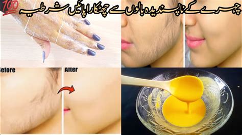 Facial Hair Removal Home Remedy Unwanted Facial Hair Skin Whitening Home Remedies Youtube