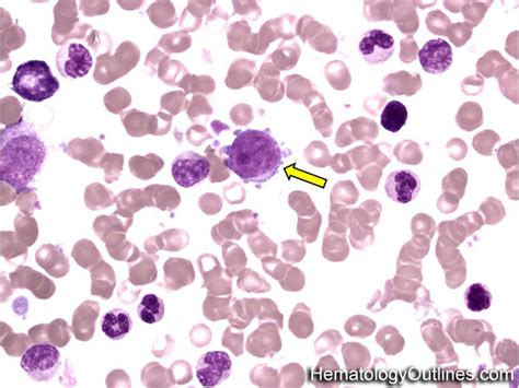 HematologyOutlines - Atlas