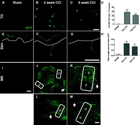 De Novo Expression Of Npy In The Trigeminal Ganglia Skin And Mental