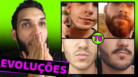 EVOLUÇÃO DOS INSCRITOS MINOXIDIL 76 YouTube