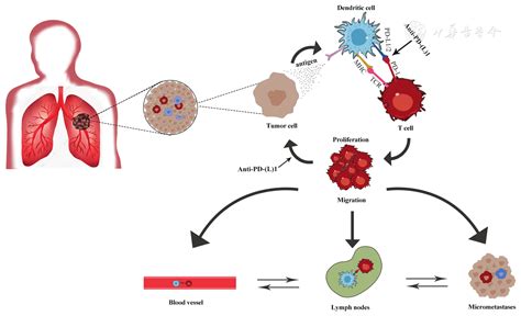 The Earlier The Better A Review Of Neoadjuvant Immunotherapy In