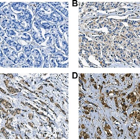 Representative Images Were Shown For Ihc Staining Intensity Of Eno1 In