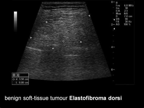 28 Dr Ahmed Esawy Imaging Oral Board Of Chest Imaging Variety Part