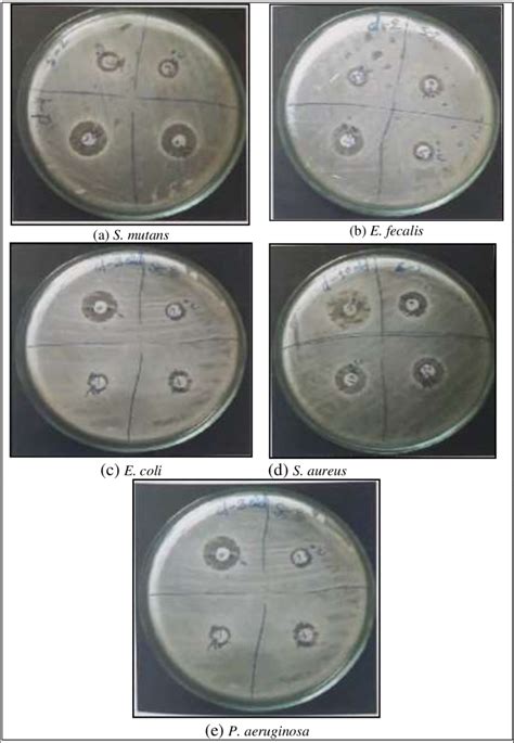 Agar Plate Showing Zone Of Inhibition Agaisnt A S Mutans B E