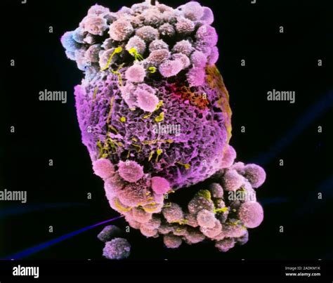 Fertilised Egg Coloured Scanning Electron Micro Graph SEM Of A