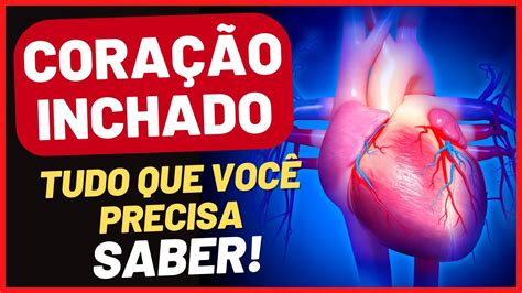 O Que É Coração Crescido - CORAÇÃO GRANDE CRESCIDO DILATADO INCHADO | O que é | CAUSAS | SINTOMAS ...