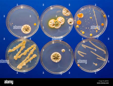 Petri Dish Bacteria Identification Chart