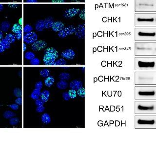 DYRK1A Knockout Enhances Radiotherapy Efficacy In Pancreatic Cancer