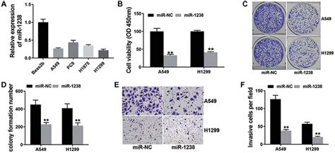 Circkif A Promotes Non Small Cell Lung Cancer Proliferation And