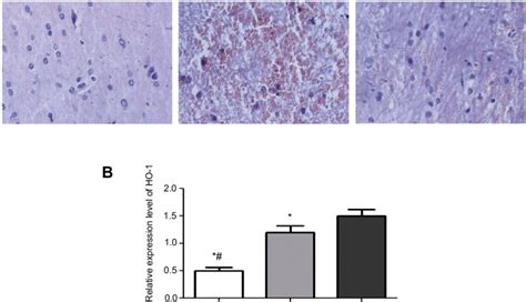 Pathological Morphology Of Rat Brain Tissue And Expression Of