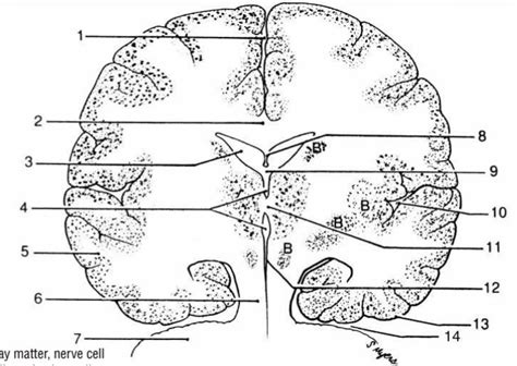 Brain Coronal Section Diagram Quizlet