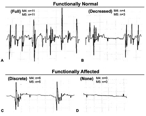 Emg Classi Fi Cation System Functionally Normal Donor Nerves Displayed