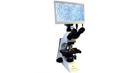 Купить Hospitex Diagnostics Microscreen. Цена 200 000р.. Микроскопы ...