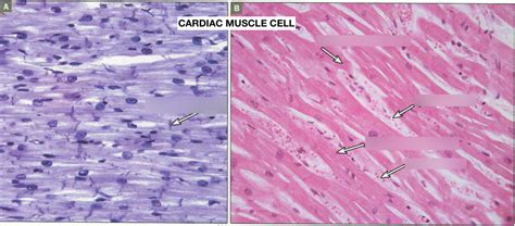 Cardiovascular: Cardiac Muscle Cell Histology Diagram | Quizlet