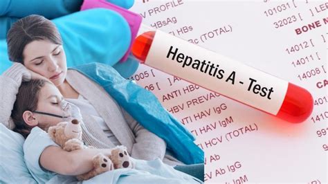 Hepatitis Aguda Infantil Cu Les Son Los S Ntomas Y C Mo Prevenir La