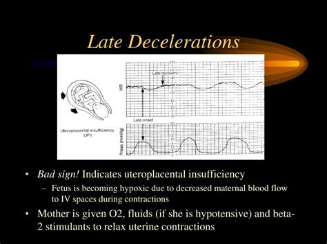 Ppt Fetal Monitoring Powerpoint Presentation Free Download Id 331037