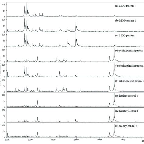 A C Positive Ion Maldi Mass Spectra Of Diluted Plasma From A An Mdd Download Scientific