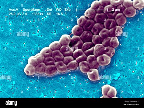 Acinetobacter Baumannii Hi Res Stock Photography And Images Alamy